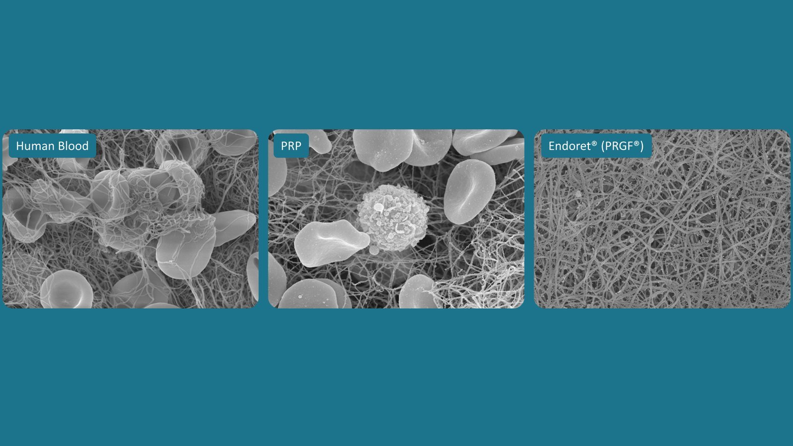 Endoret PRGF, scanning electron micrograph comparison of fibrin networks
