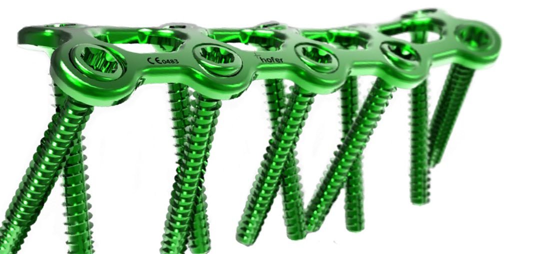 Λεπτομέρεια πράσινης πλάκας XS-INTEOS® 0,8 mm με κοχλίες υπό γωνία