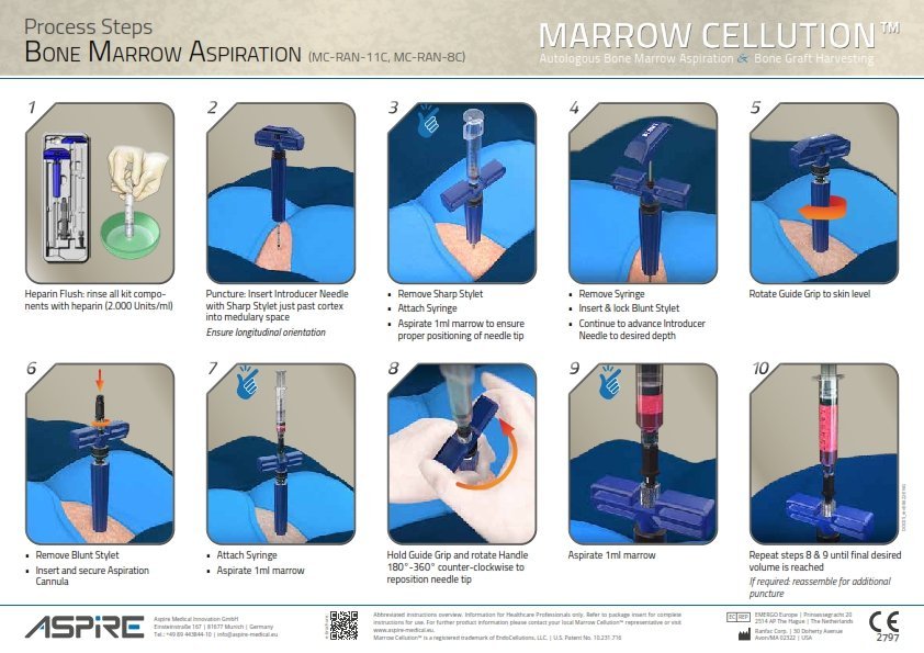 Marrow Cellution aspiration technique, step guide