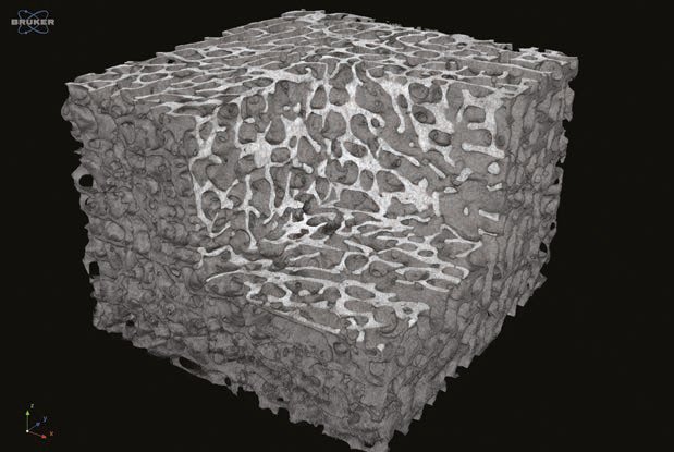 Μόσχευμα SmartBone, απόδοση μικροτομογραφίας (micro-CT) της πορώδους δομής