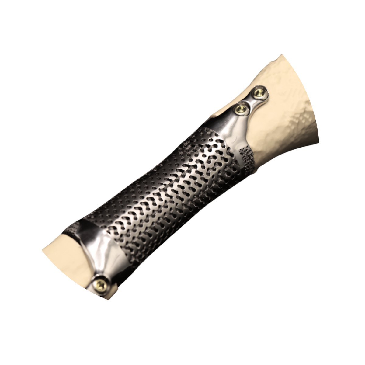 Porous titanium segment replacing a resected length of a long-bone shaft, fixed to the remaining bone at each end