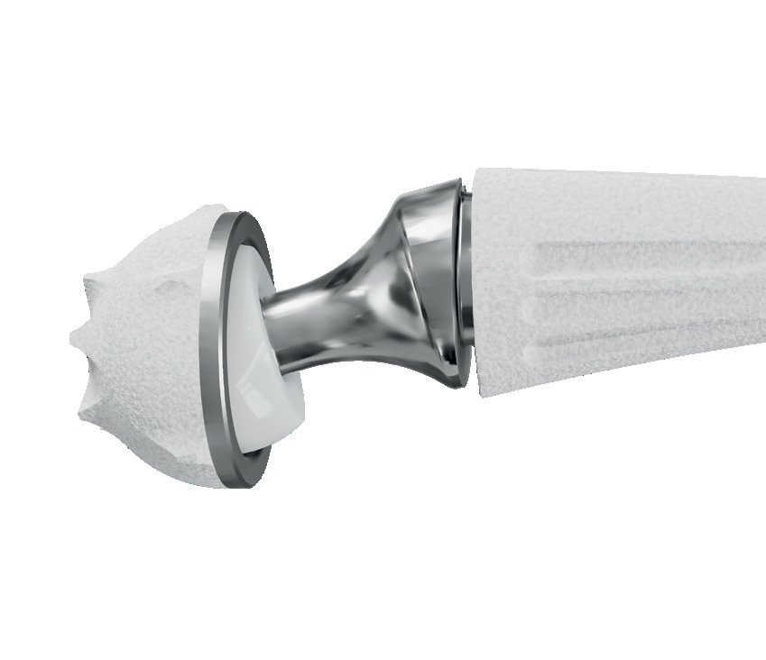 Touch CMC prosthesis, assembled implant