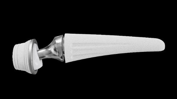 Touch CMC dual-mobility prosthesis, assembled implant